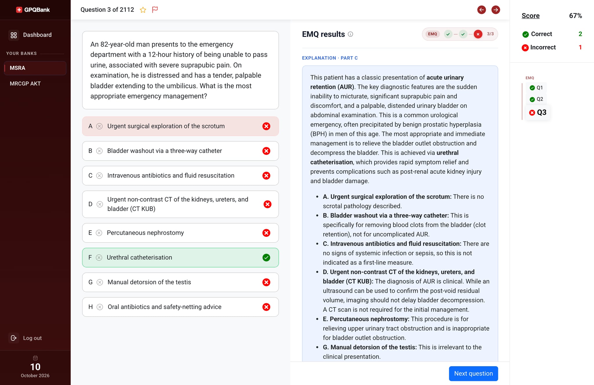 MSRA extended matching question with options and explanation